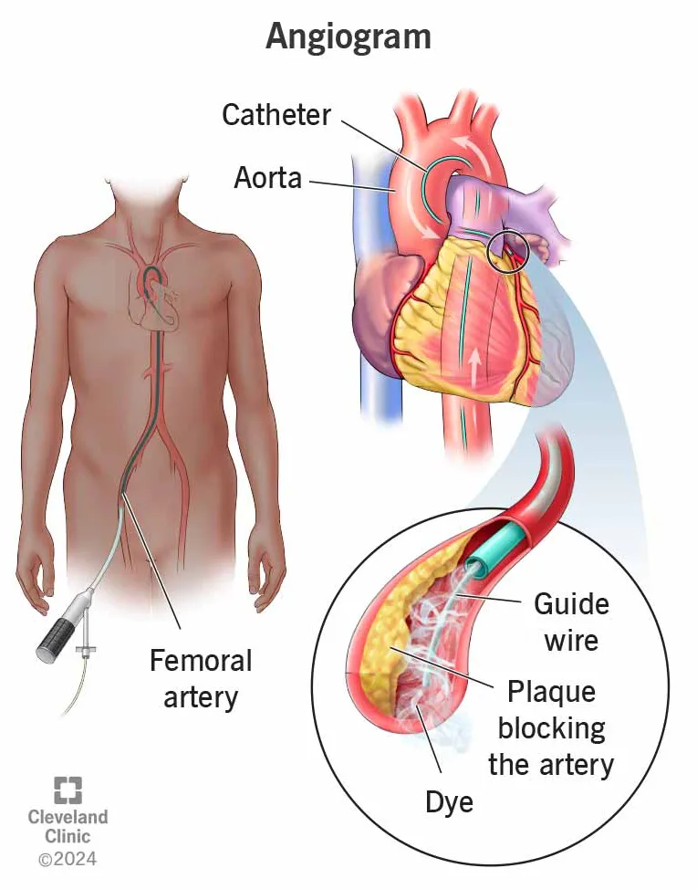 Platinum Hospital is known as a reliable place for advanced heart care and is one of the best