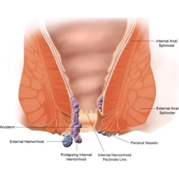 Piles Treatment in Thane – Modern Solutions for Lasting Comfort