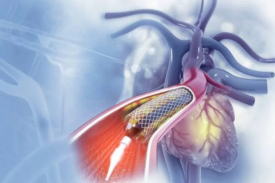 Platinum Hospital, Pune: Leading the Way in Cardiac Services Including Angioplasty