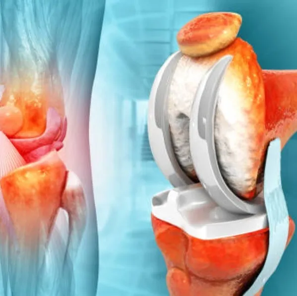 Looking for best orthopedic doctor in Warje ? Platinum Multispeciality Hospital – A name you can tru...