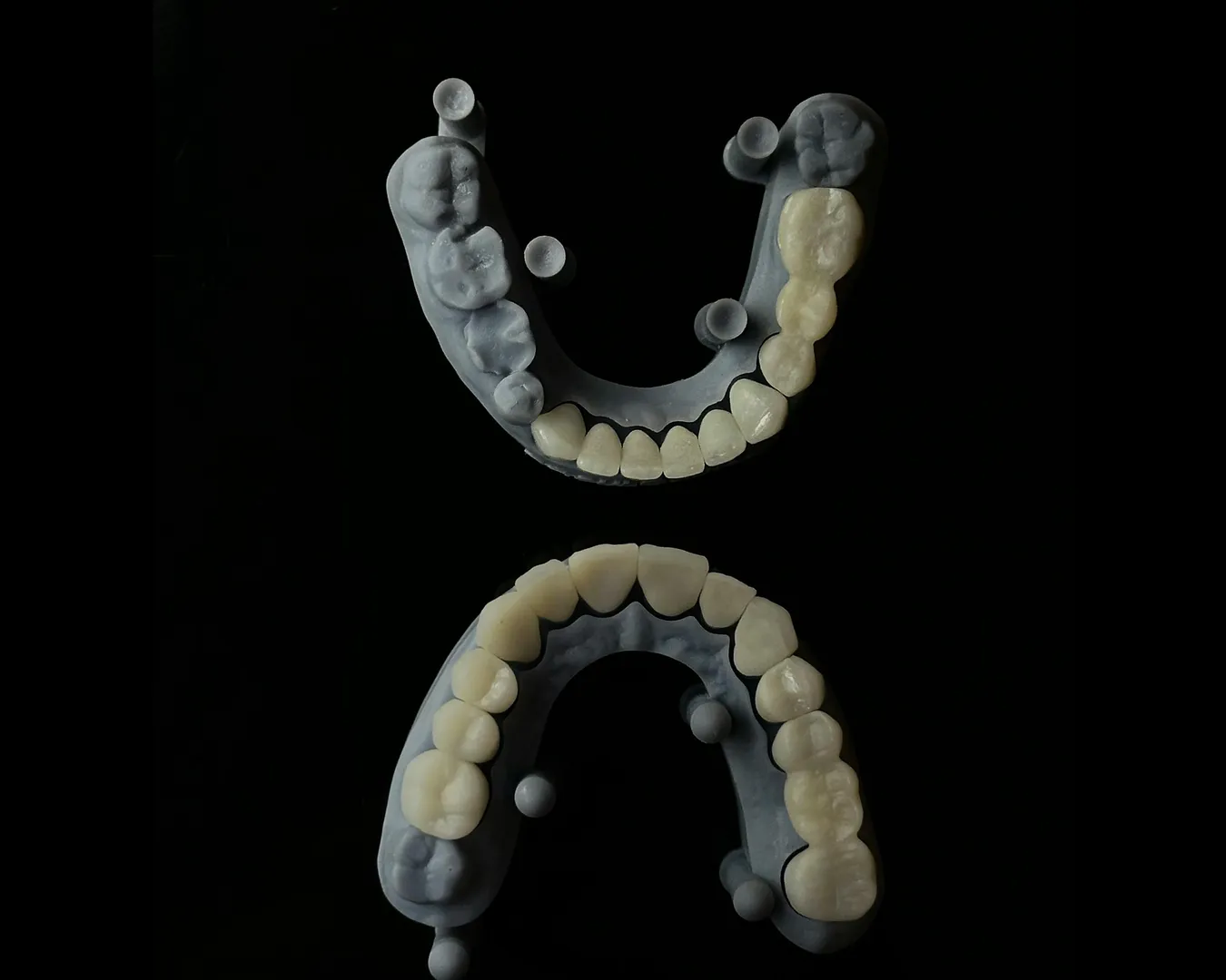 Affordable Tooth Caps & Crowns Near Me In Charni Road Mumbai