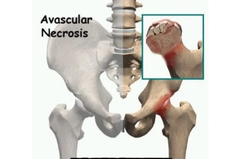 Best Orthopedic Hospital in Nagpur