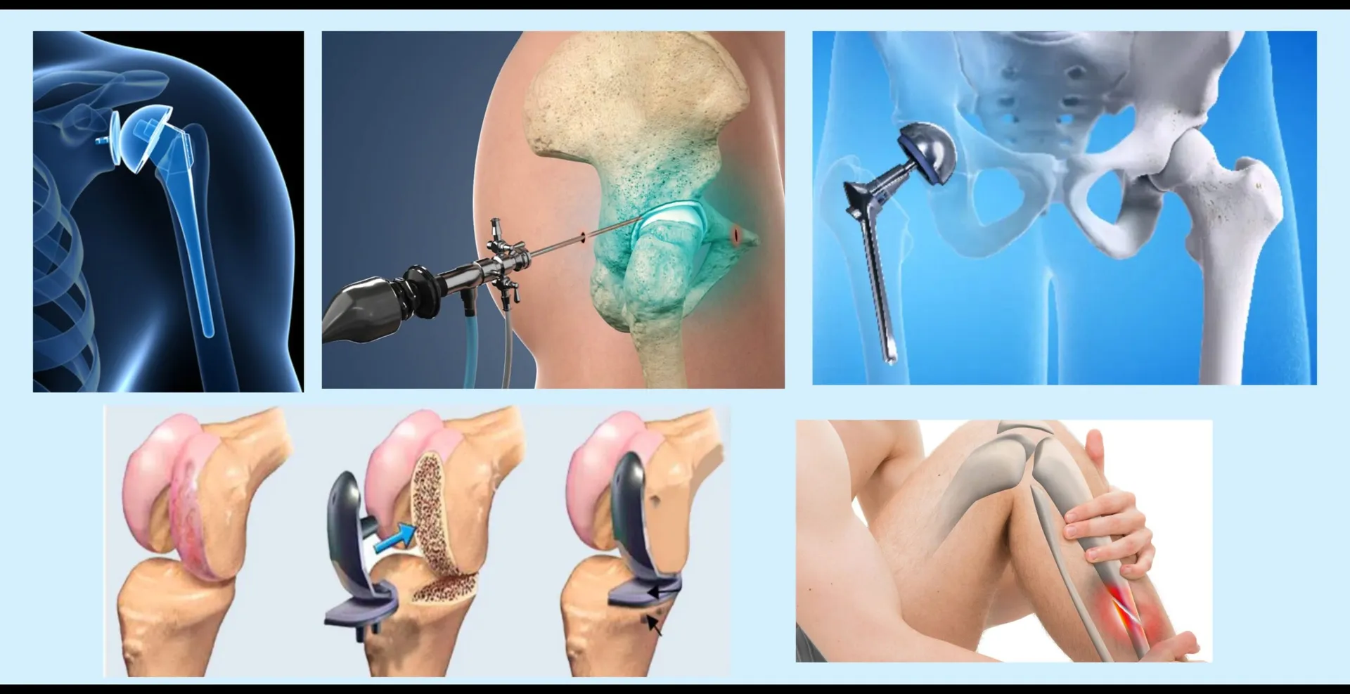 Platinum Hospital, Warje–Shivane provides state-of-the-art orthopedic care with successful surgeries...