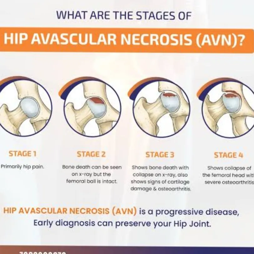 Best Orthopedic Hospital in Nagpur