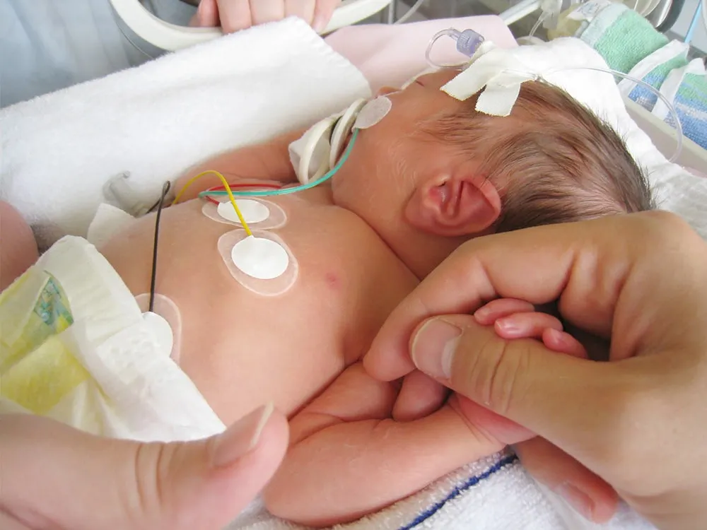 Platinum Hospital is a trusted NICU care hospital near Kothrud, Pune, providing advanced neonatal an...