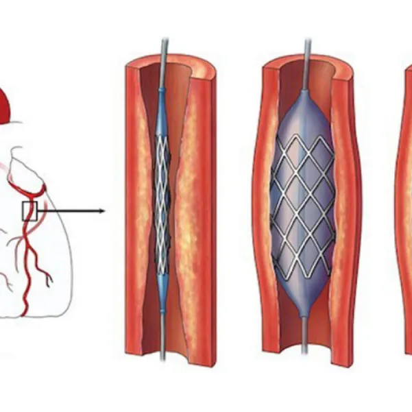 Platinum Hospital is a leading Heart Care and Surgical Hospital in Pune, providing advanced and affo...