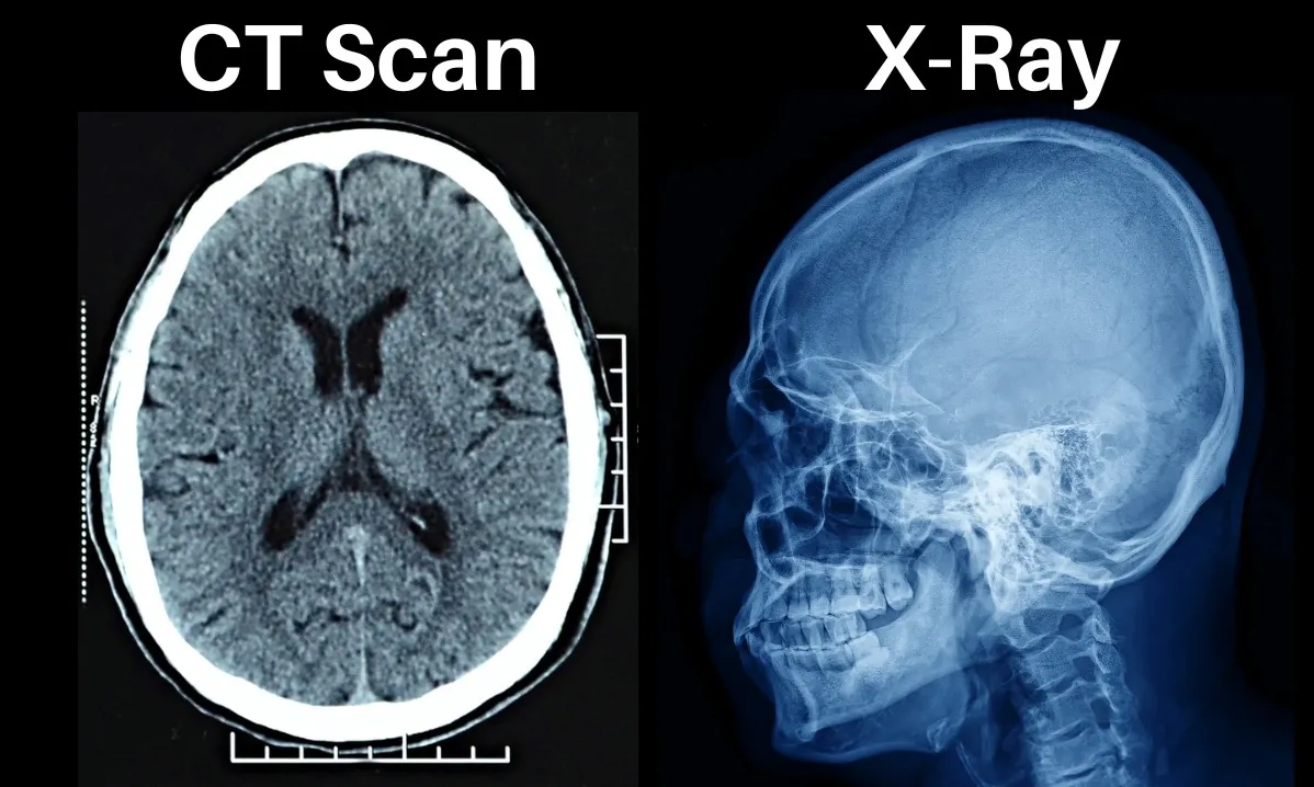 latinum Hospital is a trusted diagnostic and healthcare center offering advanced X-ray services near...