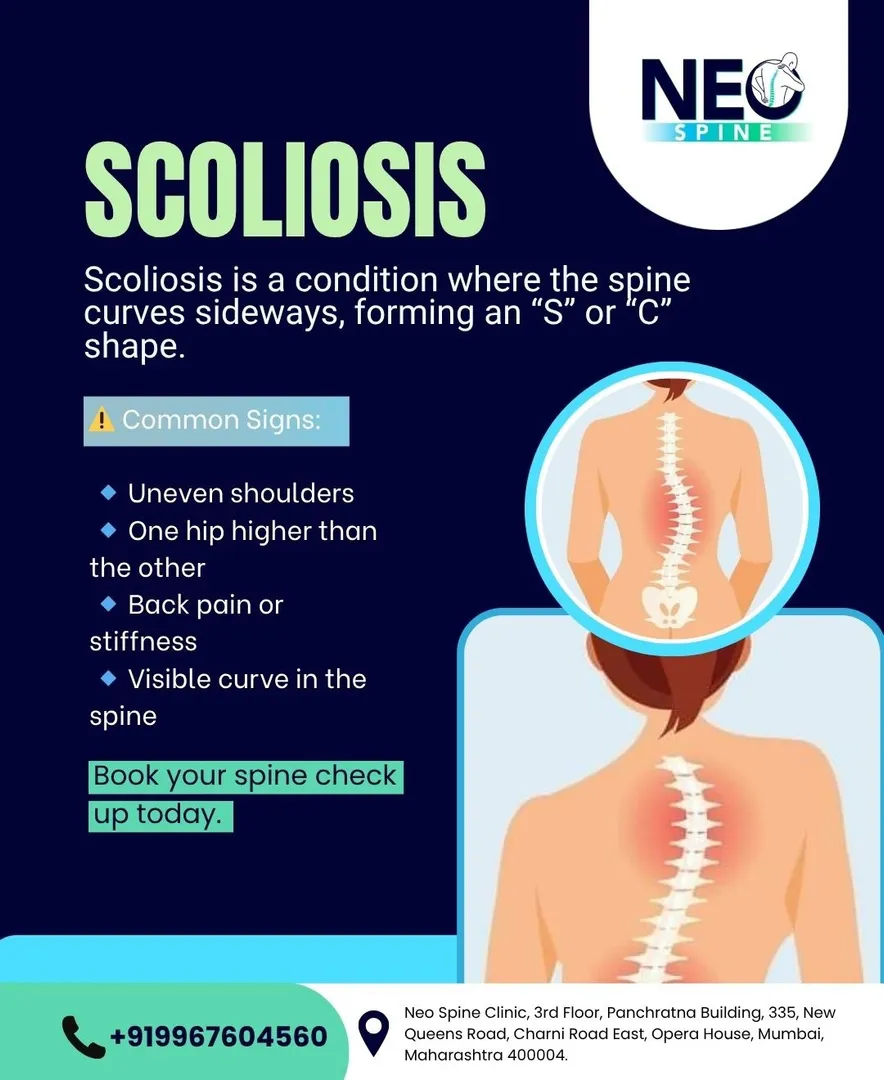 Scoliosis is a condition where the spine curves sideways, which may lead to uneven shoulders, back p...