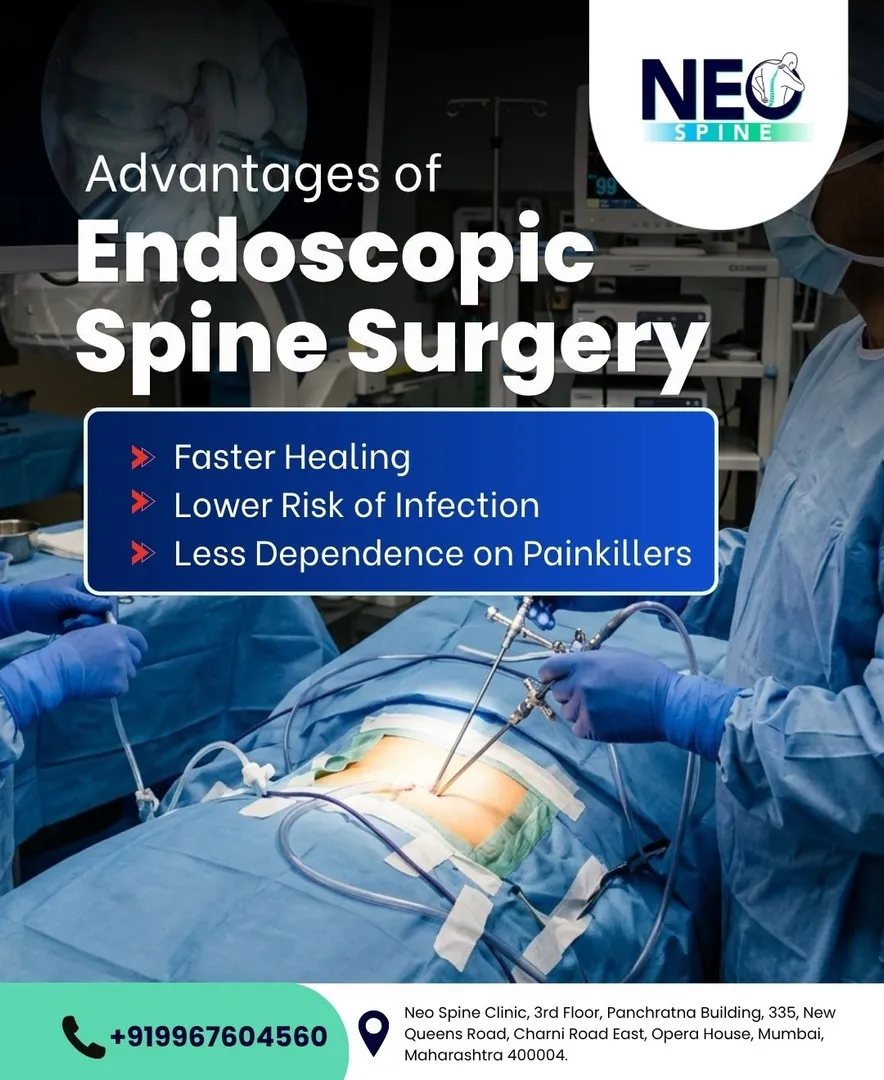 Endoscopic spine surgery is an advanced minimally invasive procedure used to treat selected spine co...