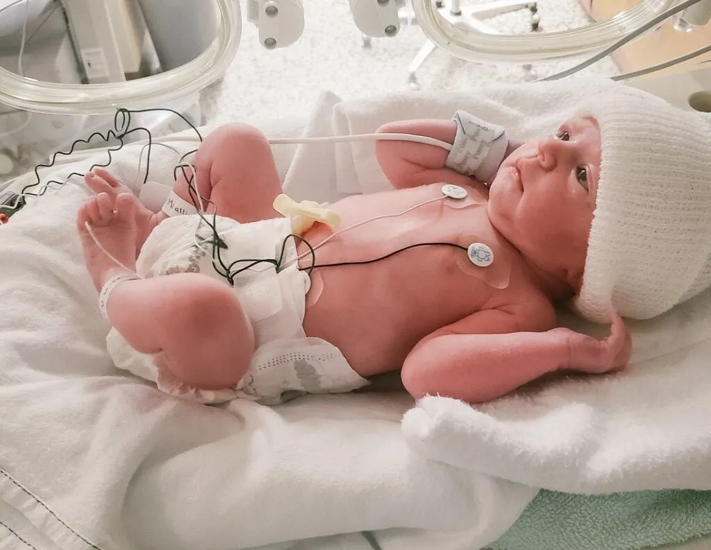 Platinum Hospital near Shivane is equipped with a well-equipped NICU with advanced life support syst...