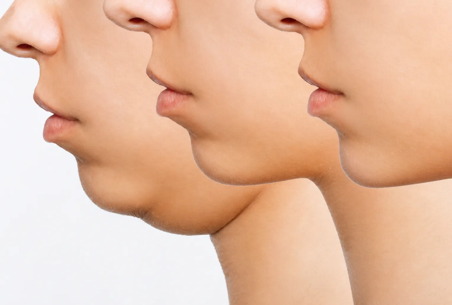 Double Chin Reduction in Pune for a Sharper Jawline
