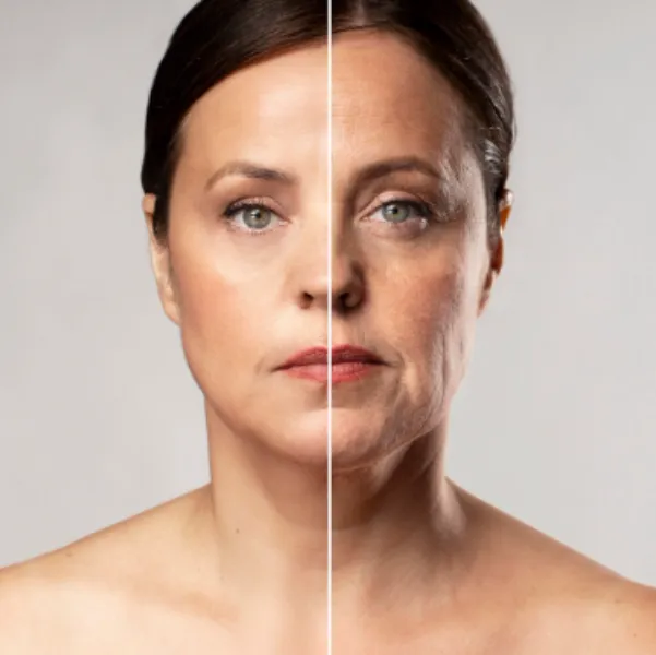 Antiaging Treatment in Mumbai - Supporting Healthier and Younger Looking Skin