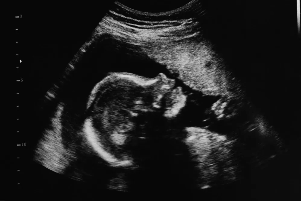 Fetal Anomaly Scan in Navi Mumbai – Early Detection for Your Baby's Health