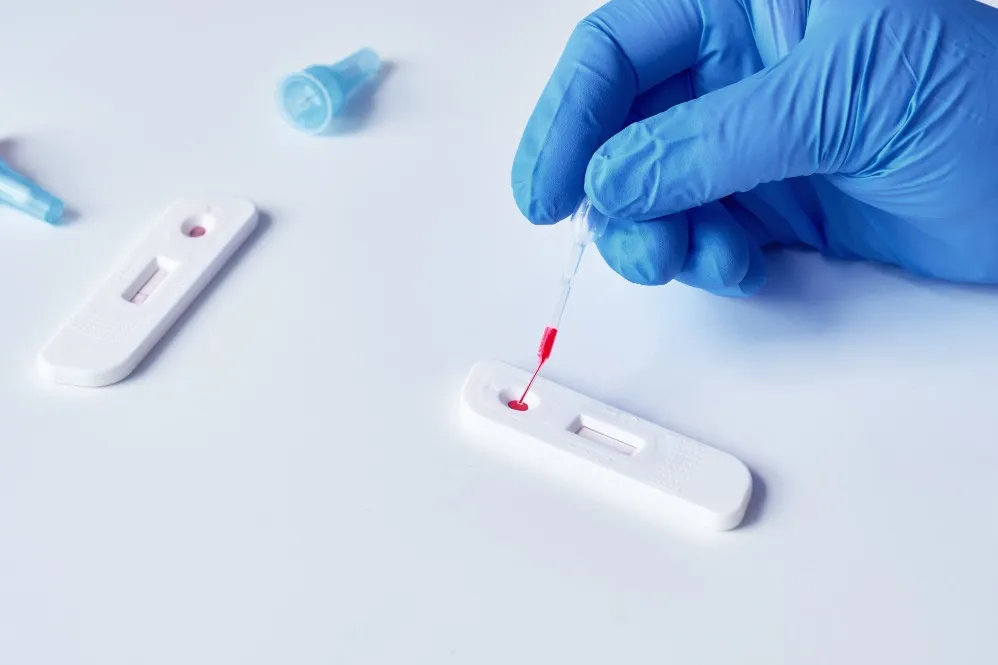 Antibody Test in Dwarka Sector 4 - Understanding Your Immunity Status Clearly