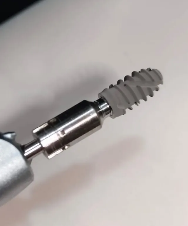 Dental Implant Costs in India vs USA, UK & Dubai