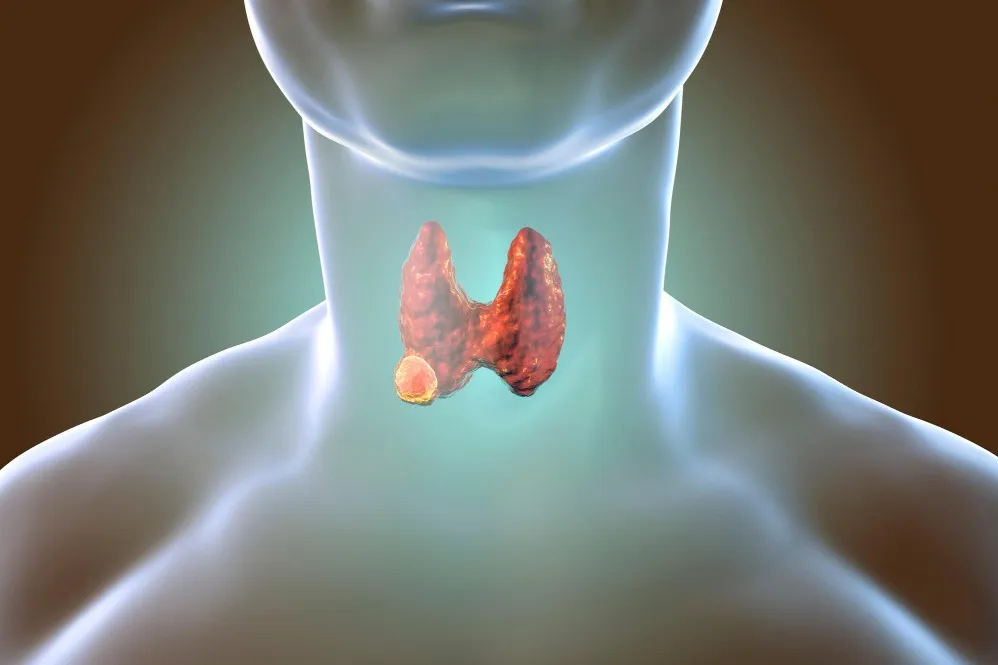 Thyroid Tumor Treatment in Rahatni for Changes That Should Not Be Overlooked