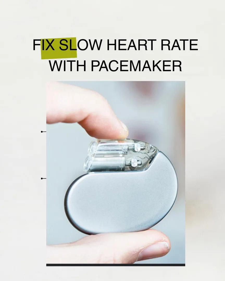 Pacemaker: A Life-Saving Solution for Slow/Irregular Heartbeats in Panvel