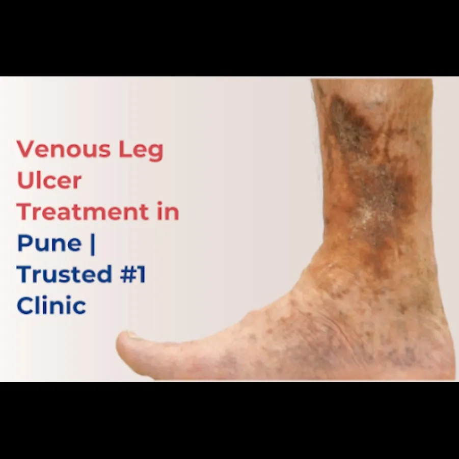 Best Vascular Specialist in Pune |