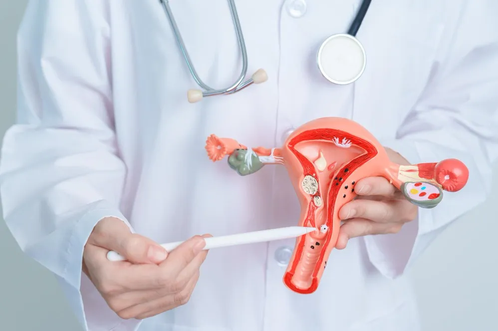 Fibroids Treatment in Parsik Nagar – Comprehensive Care for Uterine Fibroids