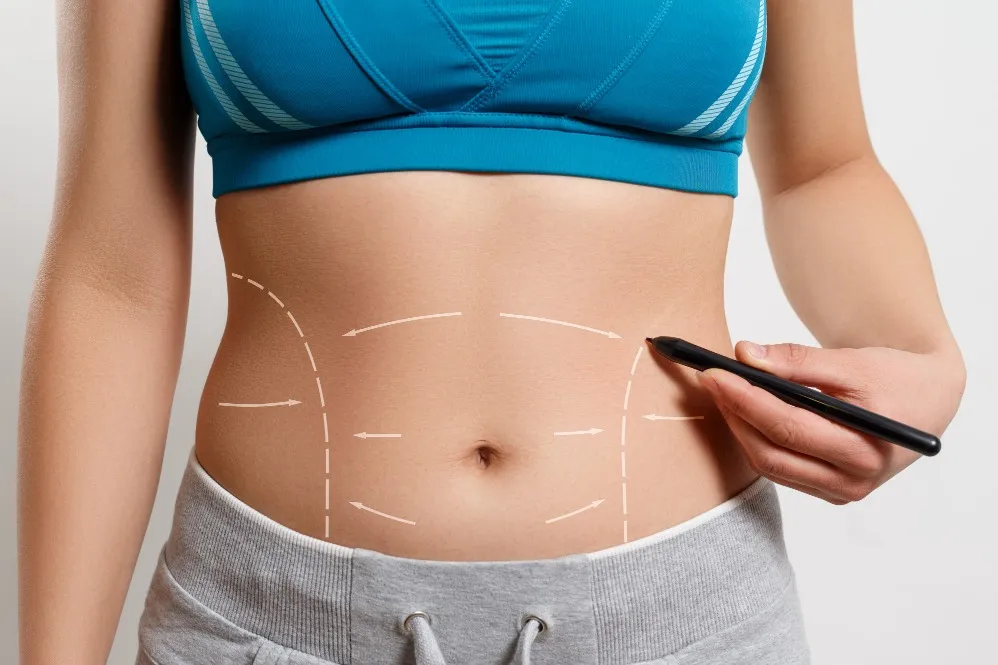 Liposuction in Bengaluru for Targeted Fat Reduction and Body Contouring