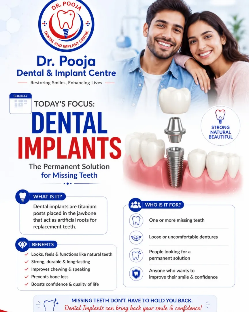 dental implants