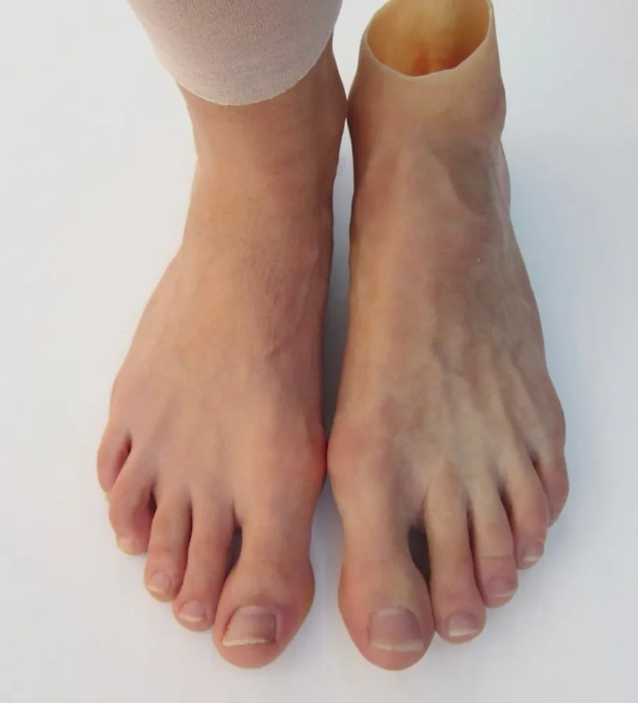 Partial Foot Prosthesis Available in Kalwa Thane