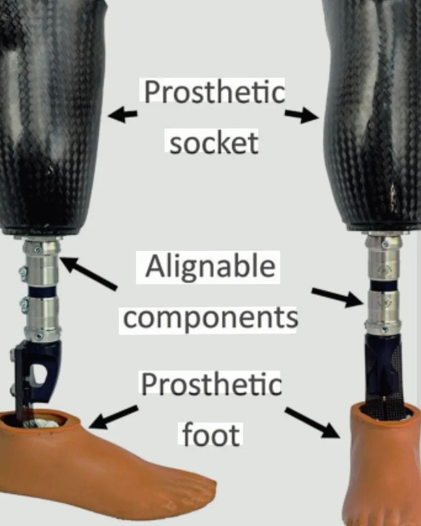 Trasistable Prothesis Available in Kalwa Thane