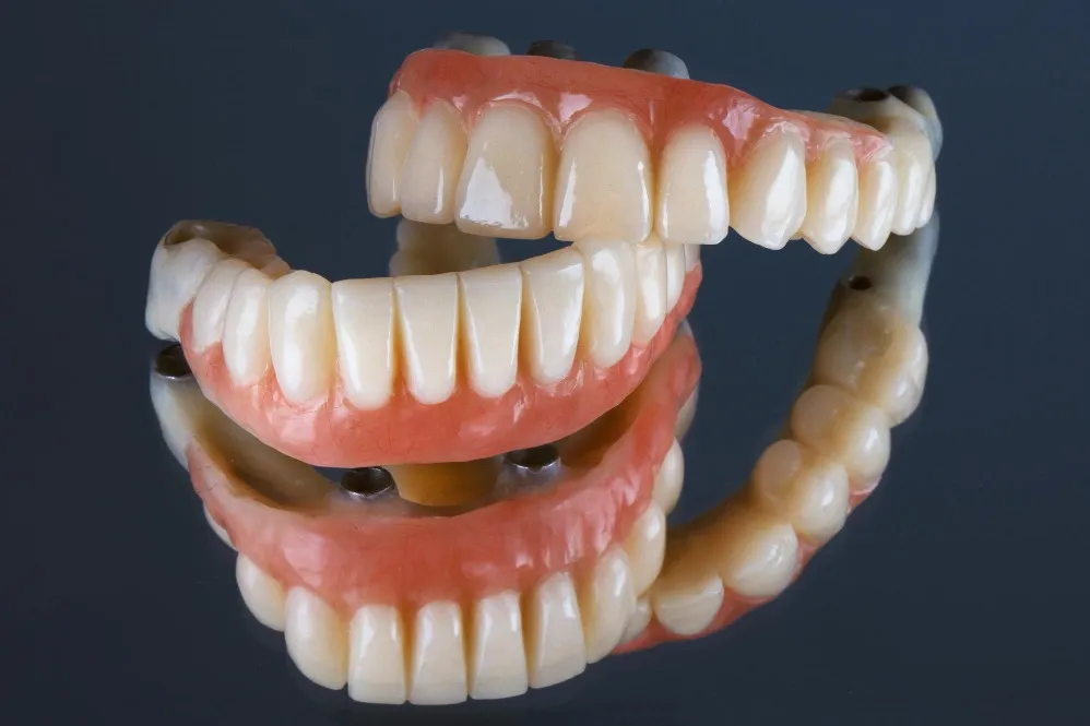 Full Mouth Implants in Dwarka to Restore Complete Smile and Chewing Comfort