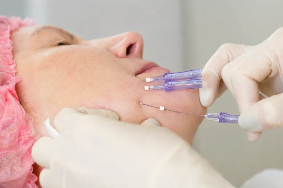 Thread Lifting in Pune for Non-Surgical Facial Lifting