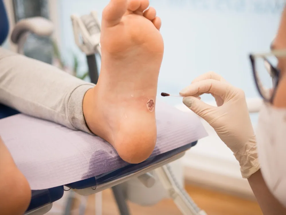Diabetic Foot Care in Navi Mumbai