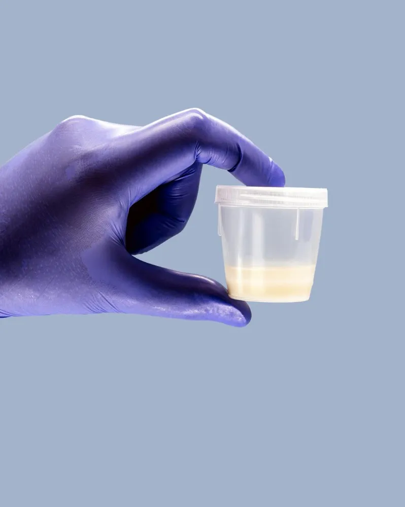 Donor sperm fertility program in Nashik a structured option for specific fertility needs