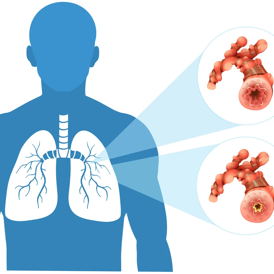 Lung Transplantation Surgeon in Jaipur – Dr. Shubham Sharma