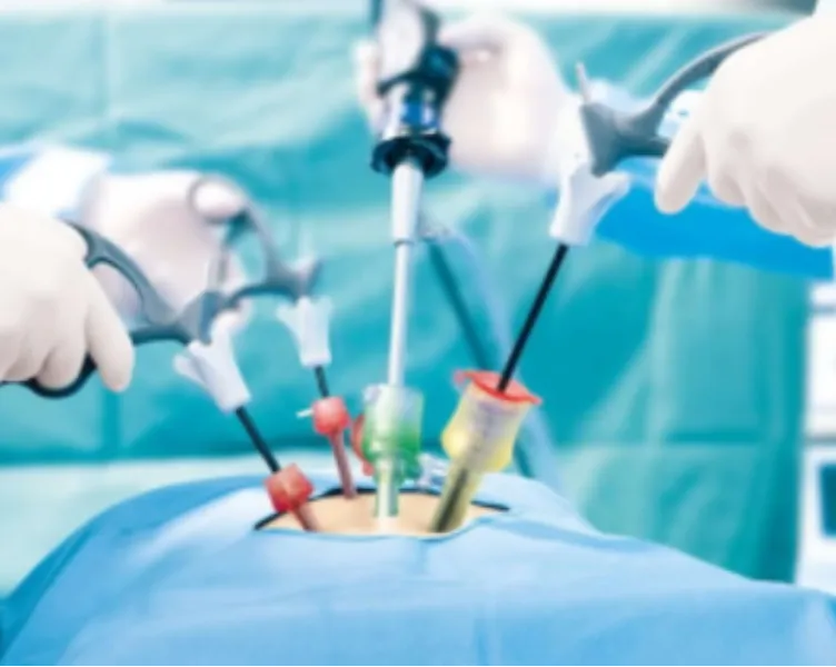 Laparoscopic Cholecystectomy Surgery in Thane for Comfortable Gallbladder Recovery