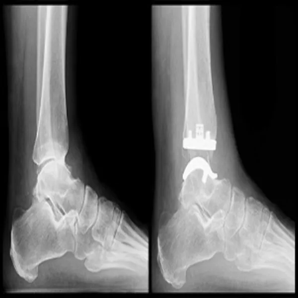 For cost-effective and expert care, contact Dr. Girish Motwani today or book an online appointment f