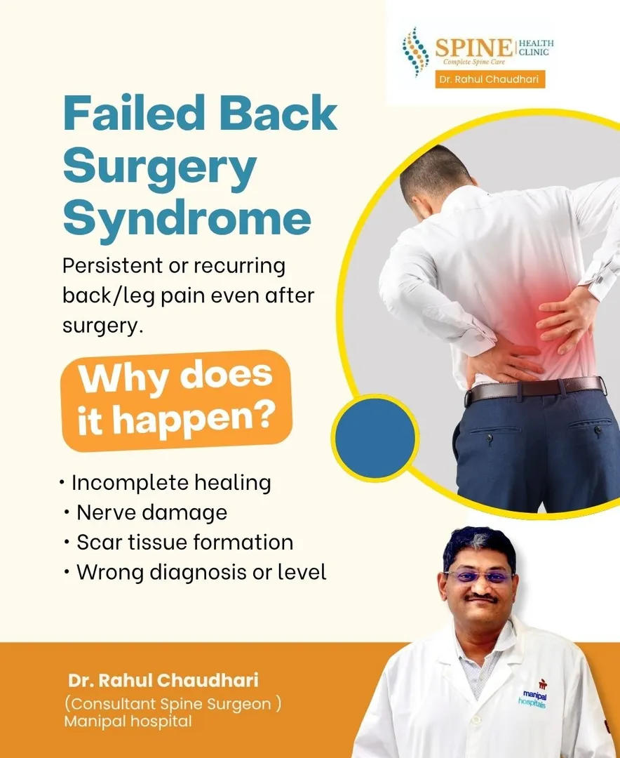 Failed Back Surgery Syndrome (FBSS