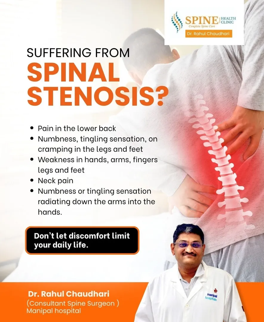 Spinal stenosis is a condition where the space inside the spine becomes narrow