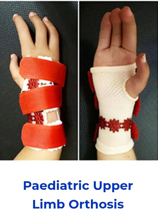 Custom Pediatric Upper Limb Orthosis Available in Kalwa Thane