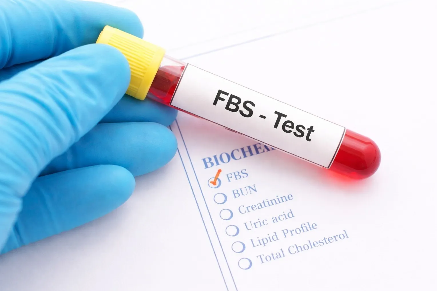 Fasting Blood Glucose Test in Thane