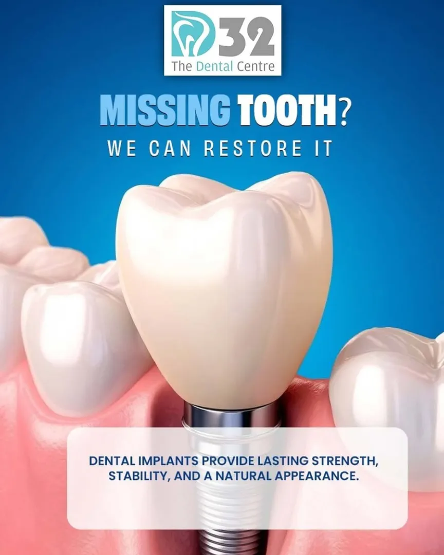 Best dental clinic for dental implant, full mouth implants, smile restoration, implant crown