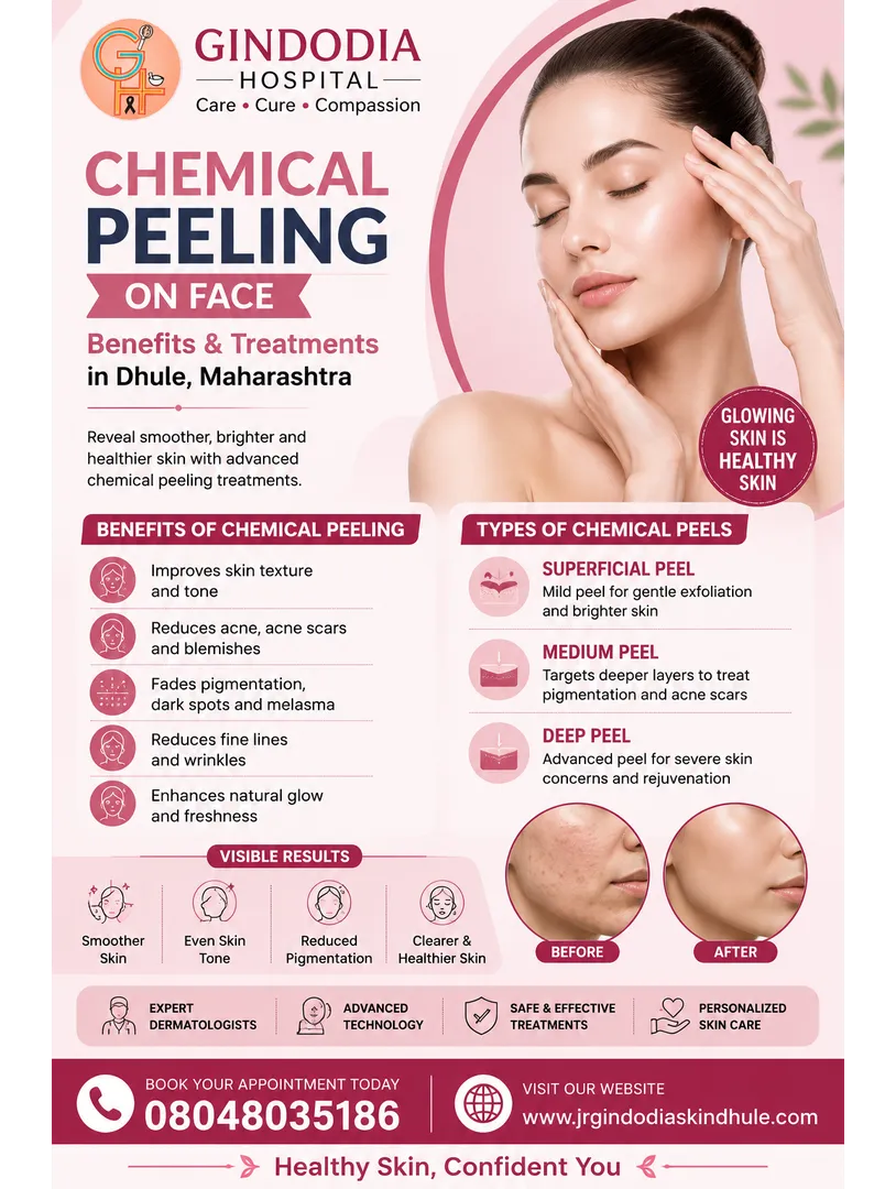 Gindodia Hospital – Chemical Peeling On Face: Benefits & Treatments in Dhule, Maharashtra