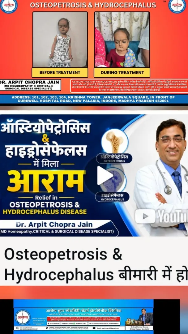 Osteopetrosis & Hydrocephalus बीमारी में होम्योपैथी से आराम–Dr Arpit K Chopra Jain Aarogya Super Spe...