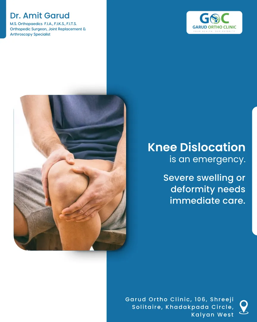 Knee Dislocation: Serious Signs You Should Never Ignore
A knee dislocation is not the same as the k...