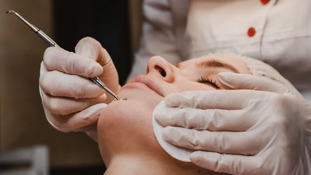 Open Pores Treatment in Vadapalani | Improve Skin Texture with Professional Care