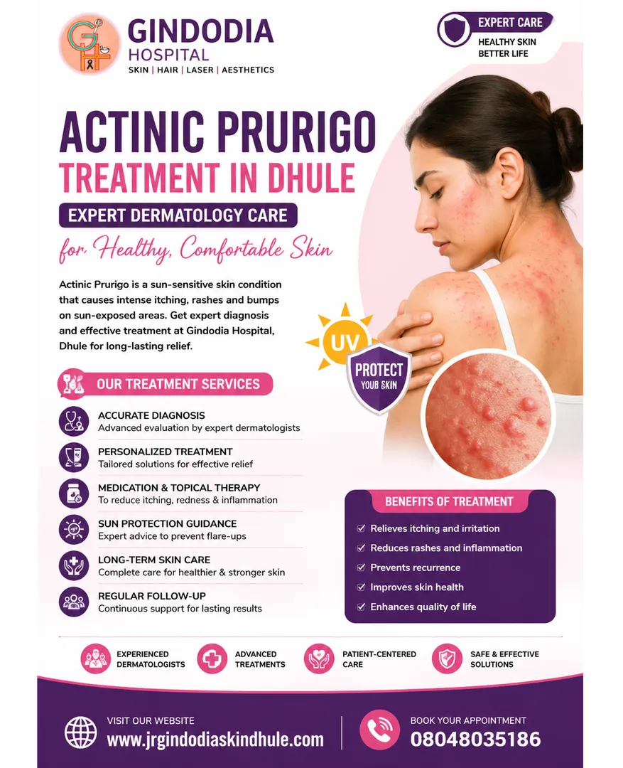 Actinic Prurigo Treatment in Dhule | Expert Dermatology Care – Gindodia Hospital