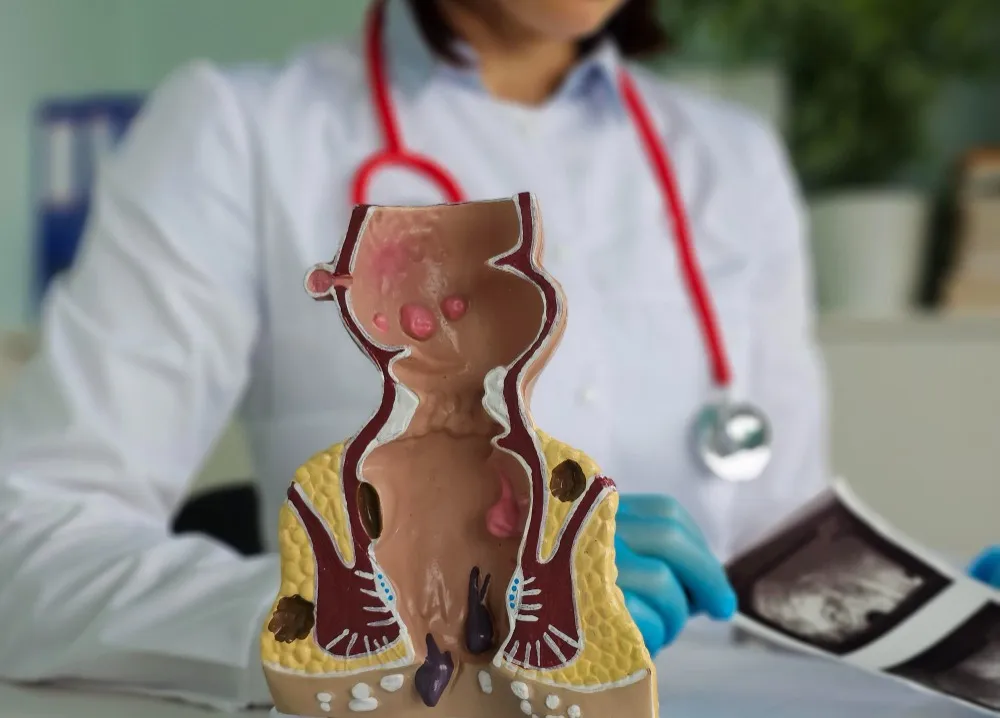 Proctologist in Kharadi