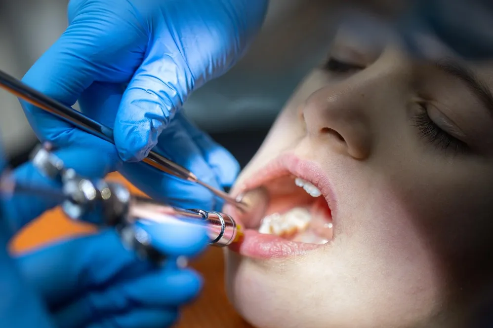Tooth Removal and Extraction Treatment in Kachrakanahalli Safe and Timely Care for Problematic Teeth