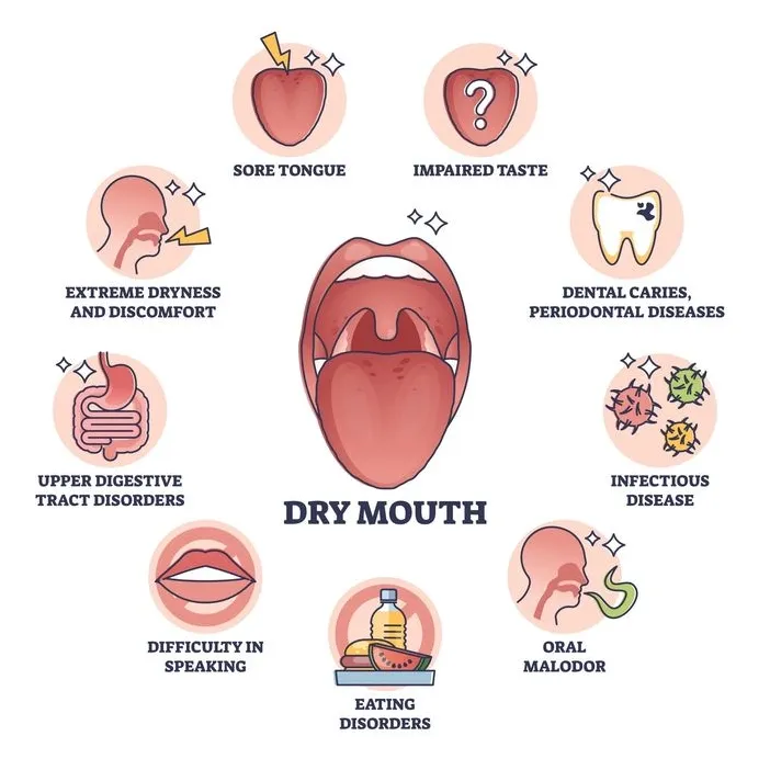 Xerostomia (Dry Mouth): Causes, Symptoms, Prevention & Treatment