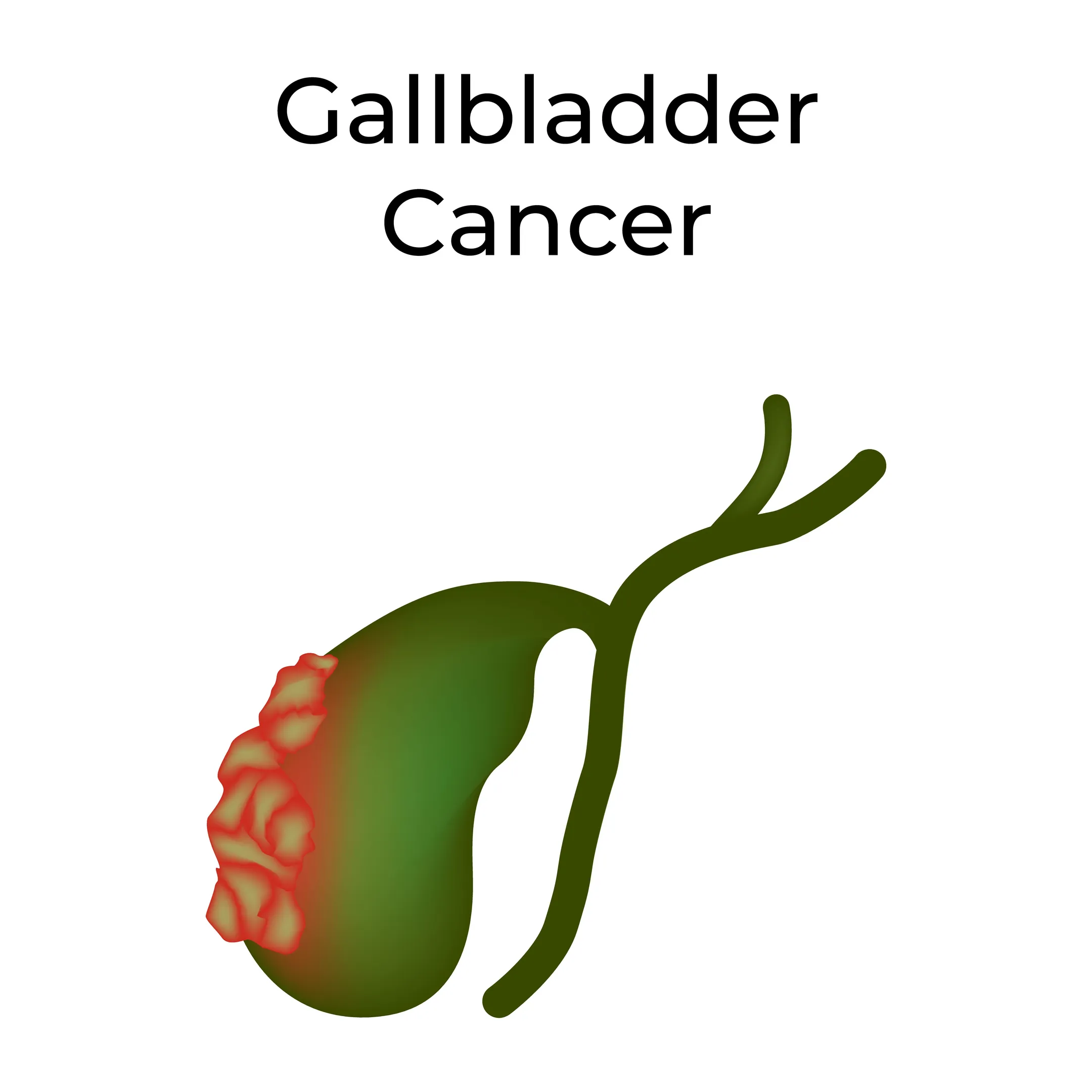 Gallbladder Cancer Treatment Specialist in PCMC – Recognizing the Signs That Matter