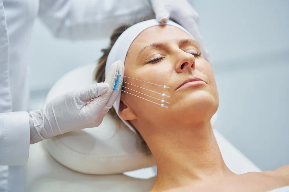 Thread Lift Skin Tightening in Mumbai A Subtle Lift Without Surgery