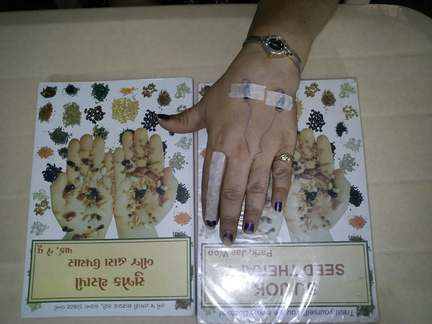 Seed Therapy Treatment in Janakpuri